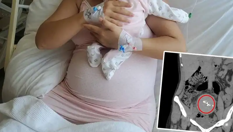 Doğumda Unutulan Bebek, İki Yıl Sonra Gazlı Bez İhmalinde Ortaya Çıktı