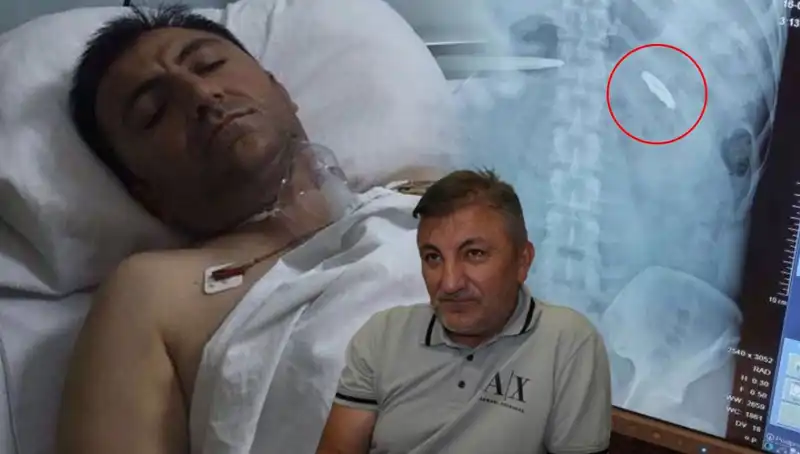 15 Temmuz Darbesinin Ardından: Kurşunla Yaralanmış Bir Hayatın Hikayesi