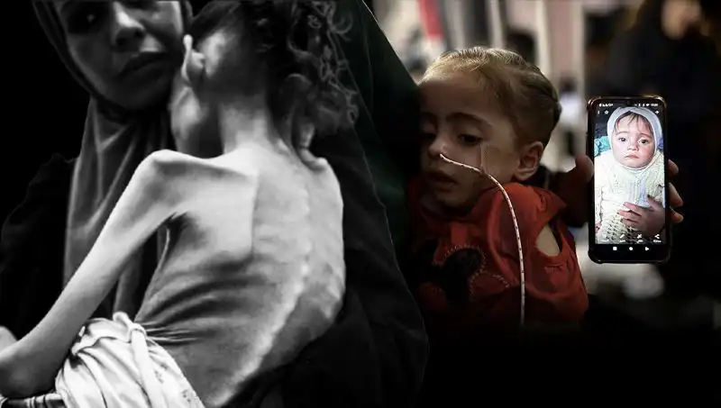 Küçük Meryem’in Mücadelesi: 25 Kilodan 10 Kiloya Düşen Yürek Burkan Hikaye