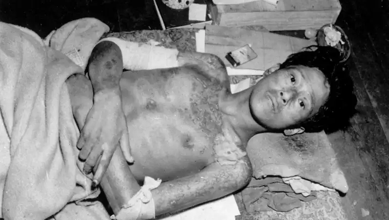 Nagasaki’den 80 Yıl Sonra Yeni Nükleer Tehdit Uyarısı: Felaket Kapıda!
